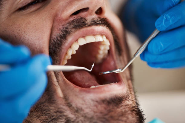 Best Pediatric Emergency Dentist in Icard, NC