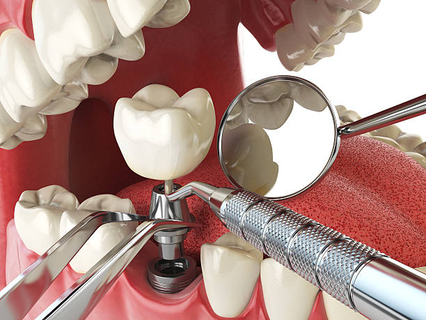 Best Emergency Denture Repair in Icard, NC